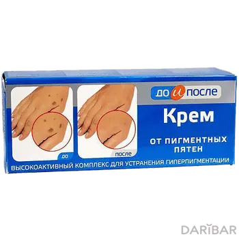 Крем До и После 50 мл от пигментных пятен