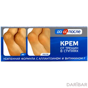 Крем До и После для ухода за кожей на ступнях 75 мл