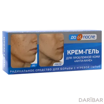 Крем для лица ДО и ПОСЛЕ 50 мл Анти-Акне